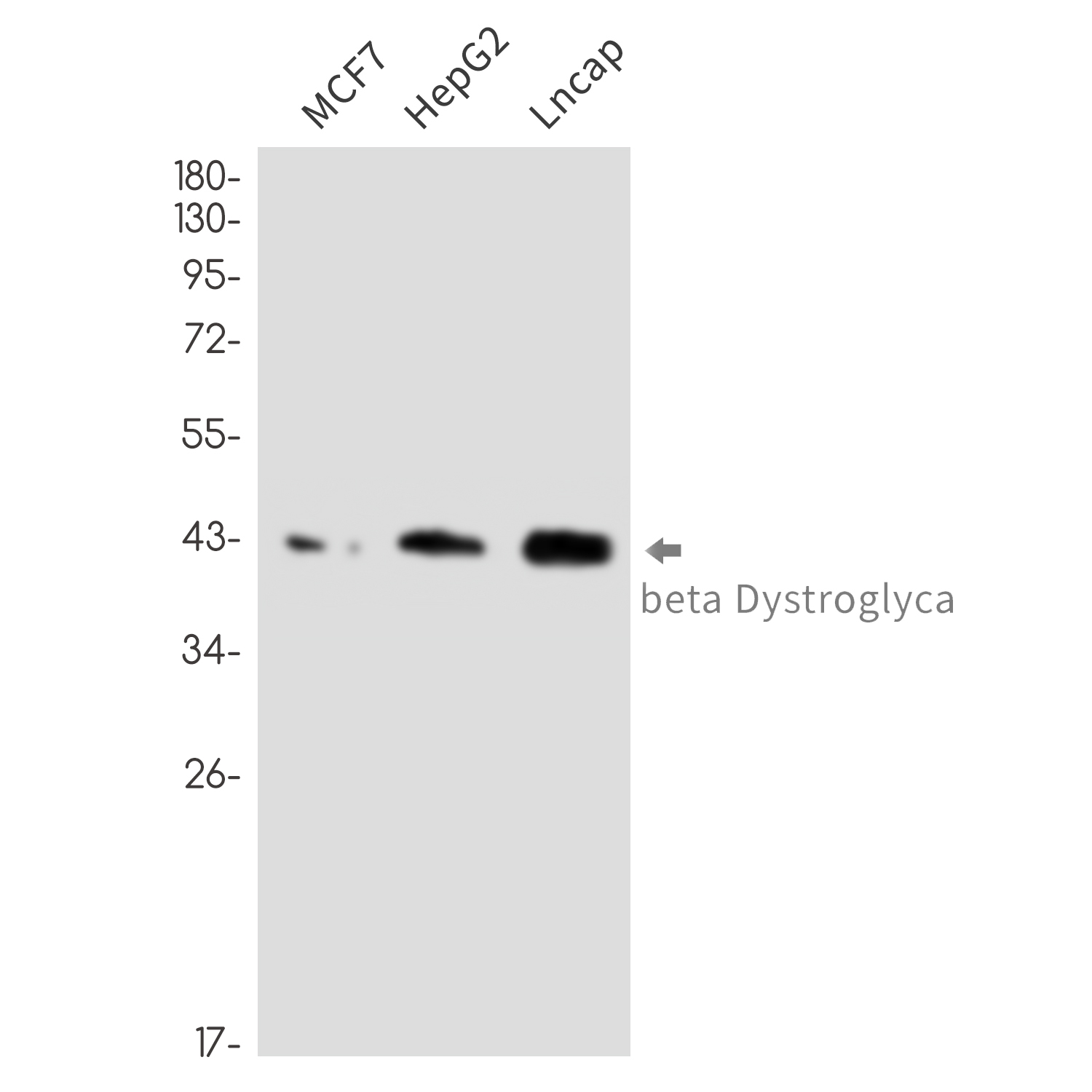 DAG1 Rabbit mAb