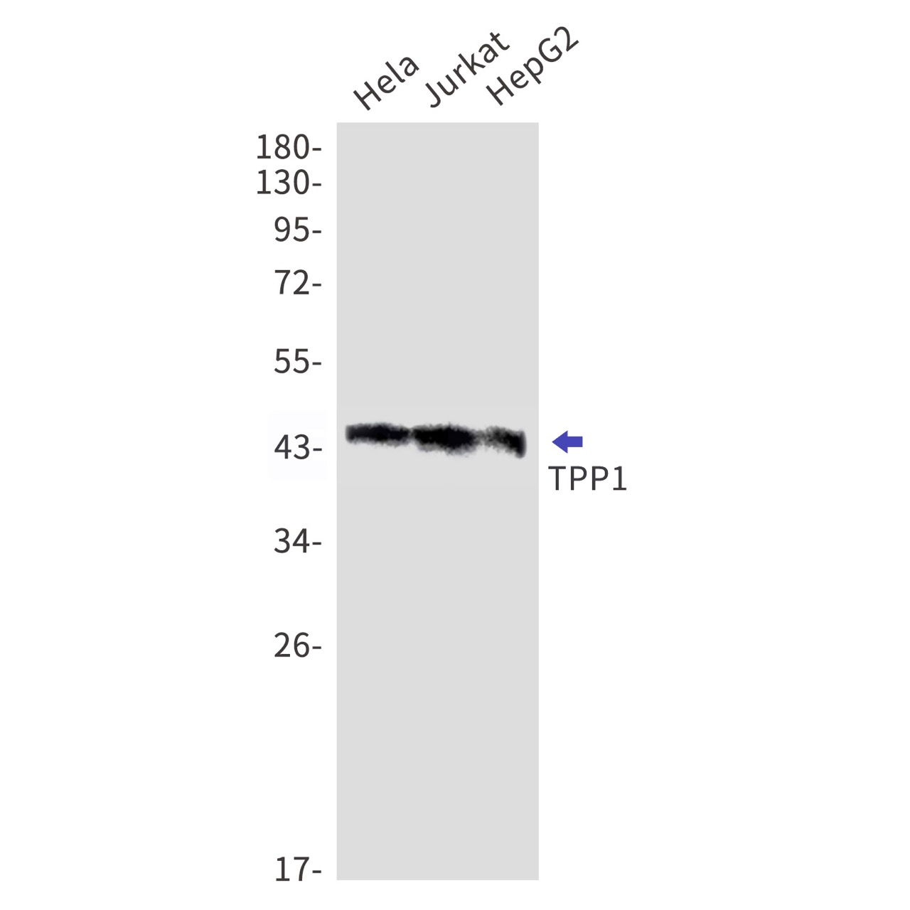 TPP1 Rabbit mAb