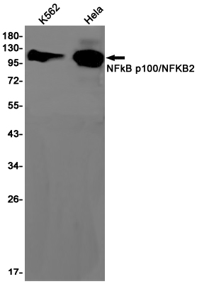 NFkB p100 Rabbit mAb