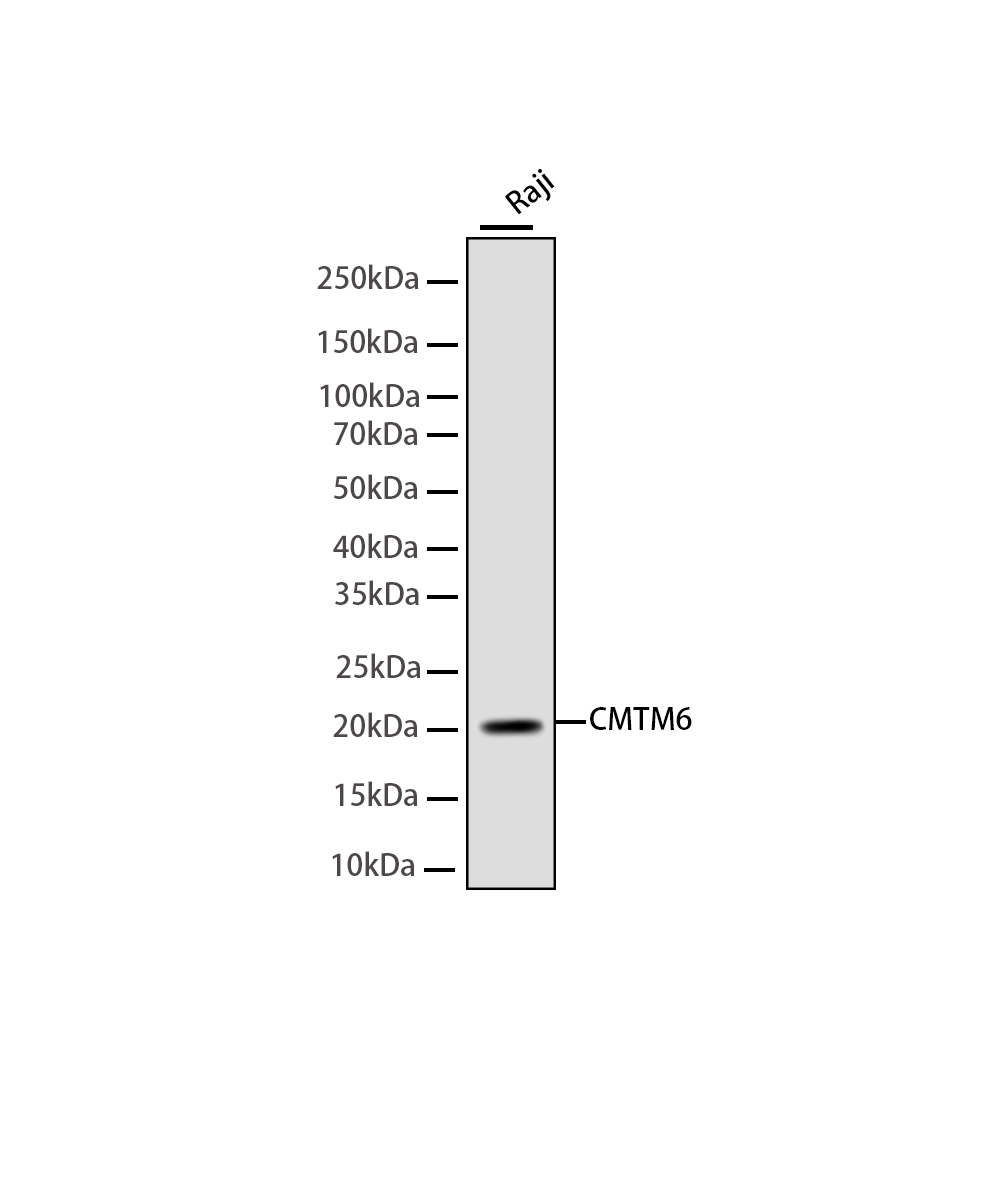 CMTM6 Rabbit mAb