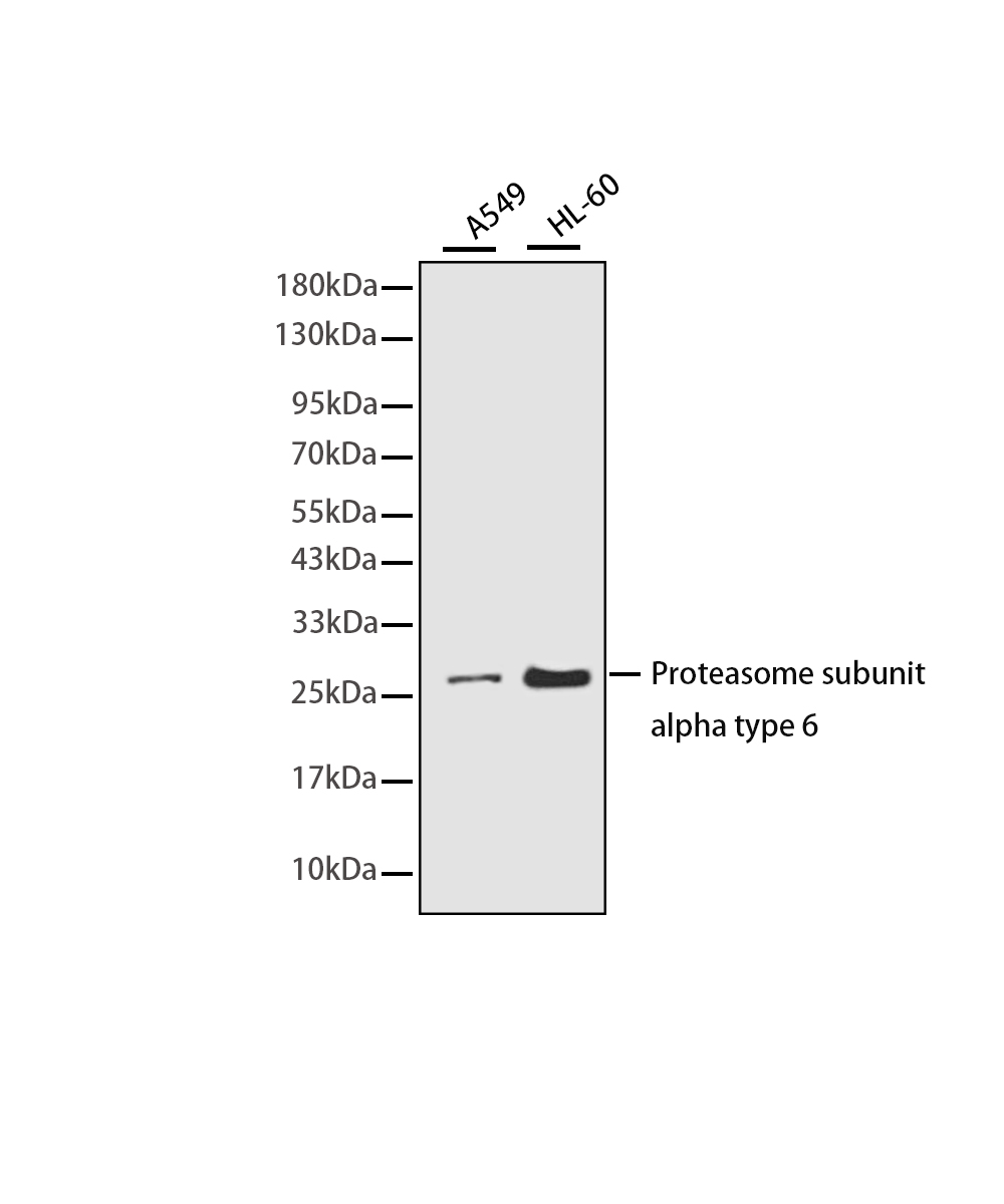 Proteasome subunit alpha type 6 Rabbit mAb