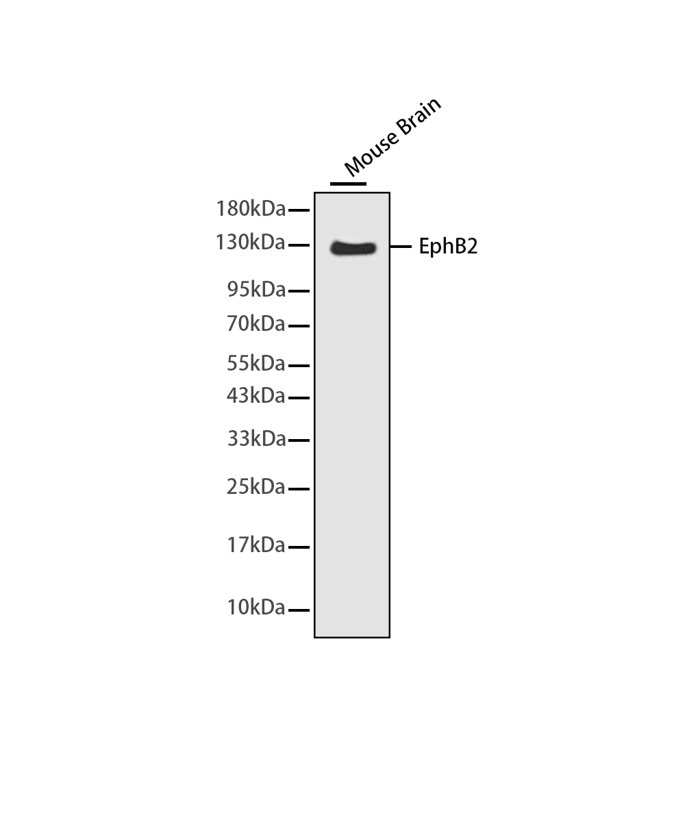 EphB2 Rabbit mAb