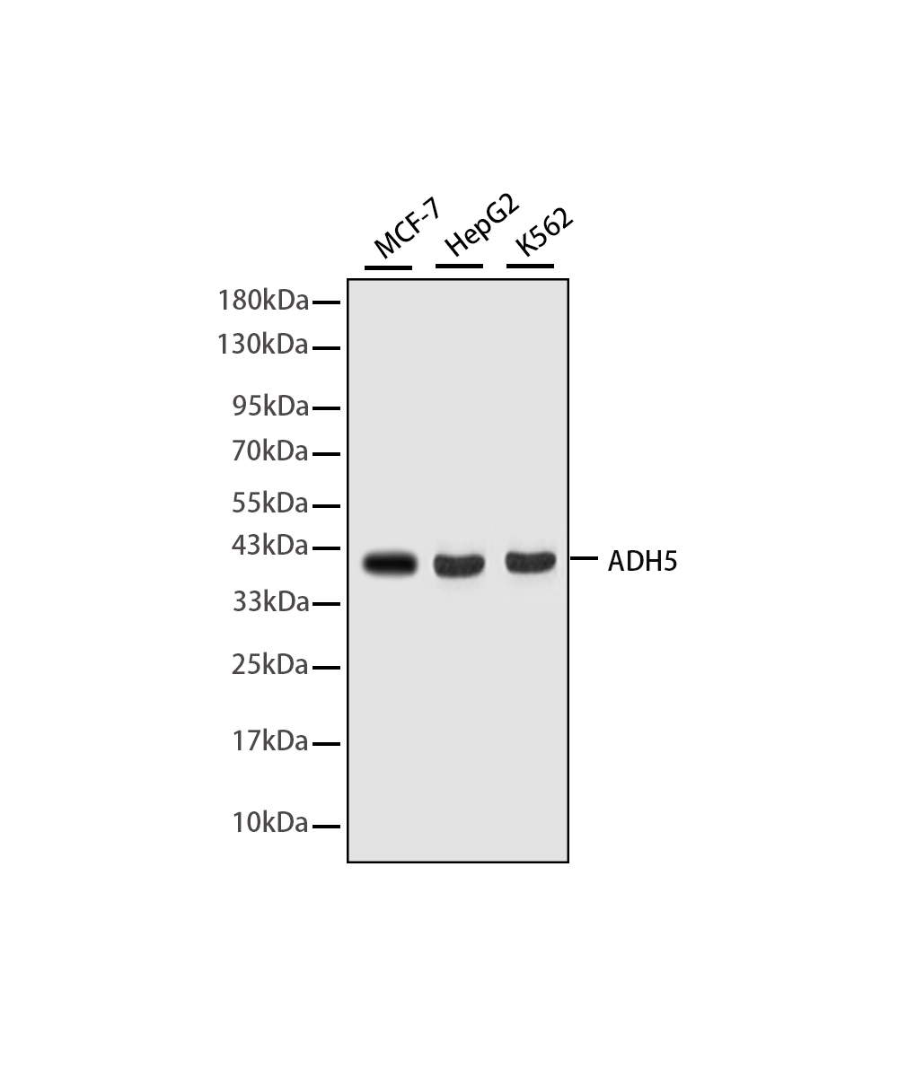 ADH5 Rabbit mAb