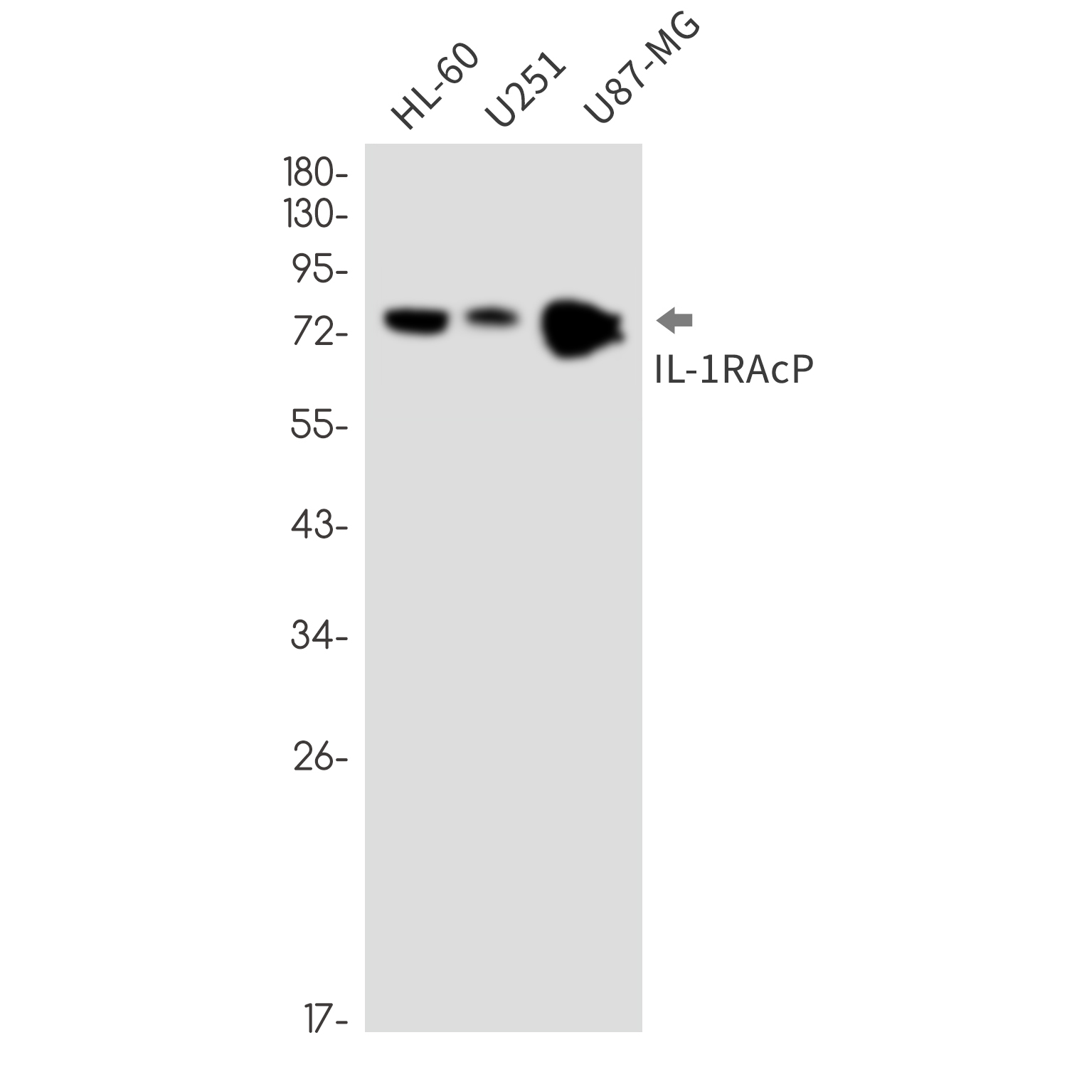 IL 1 Receptor Accessory Protein Rabbit mAb