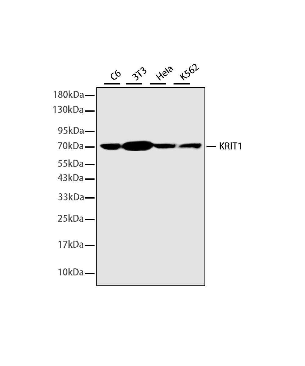 KRIT1 Rabbit mAb