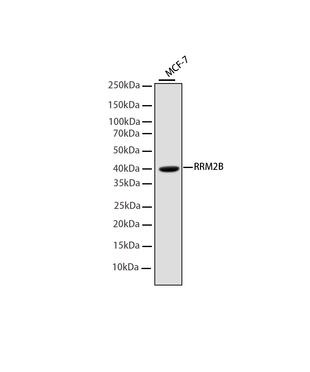 RRM2B Rabbit mAb