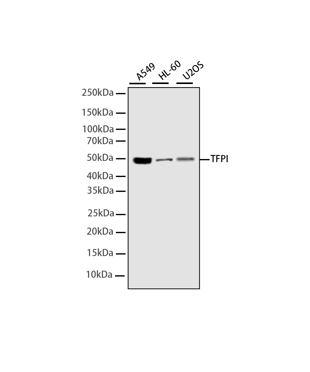 Tissue Factor Pathway Inhibitor Rabbit mAb