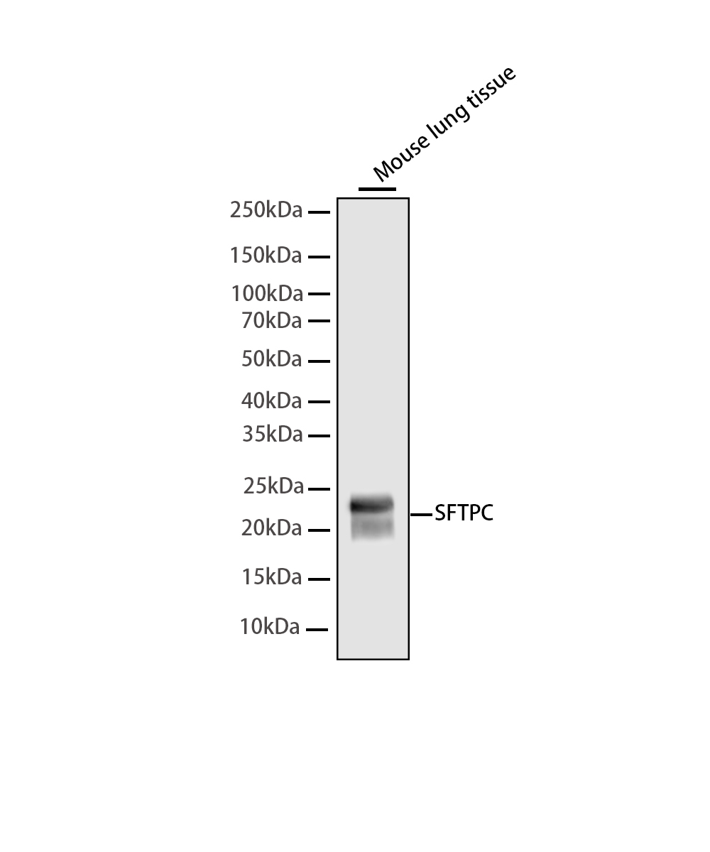 SFTPC Rabbit mAb