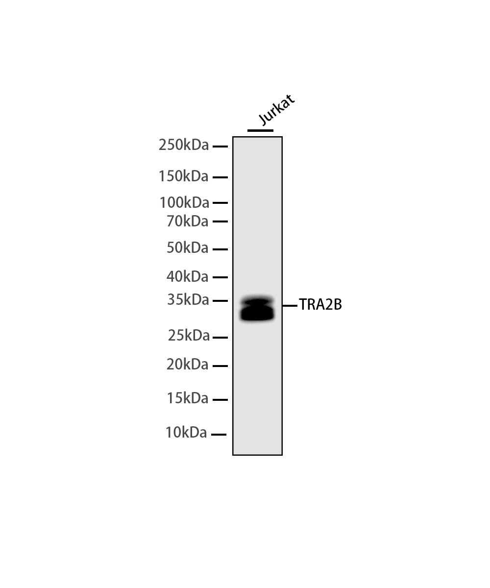 TRA2B Rabbit mAb