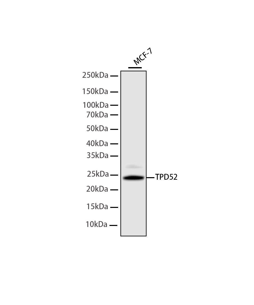 TPD52 Rabbit mAb
