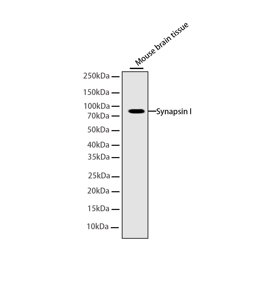 Synapsin I Rabbit mAb