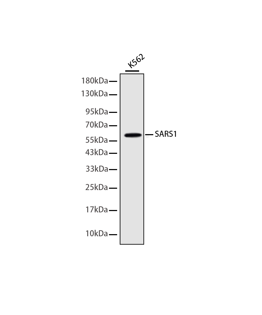 SARS1 Rabbit mAb