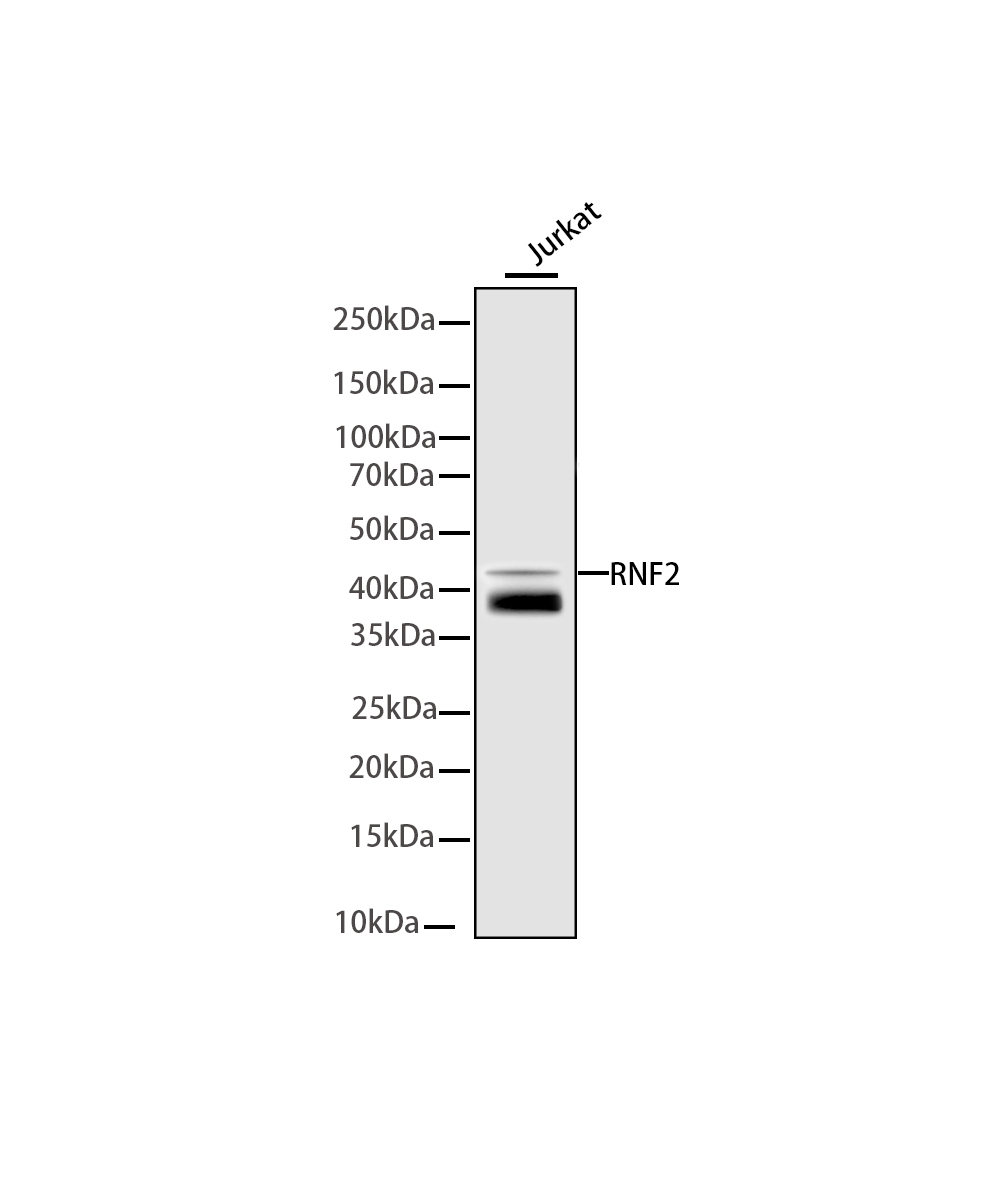 RNF2 Rabbit mAb