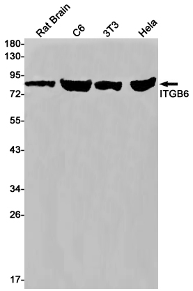 ITGB6 Rabbit mAb