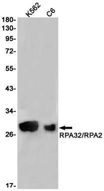 RPA32/RPA2 Rabbit mAb