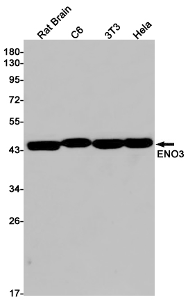 ENO1/ENO2/ENO3 Rabbit mAb