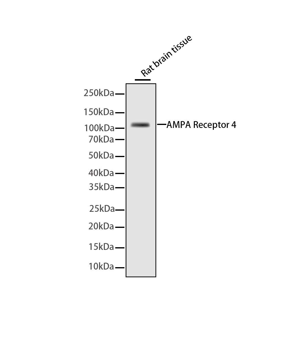 AMPA Receptor 4 Rabbit mAb