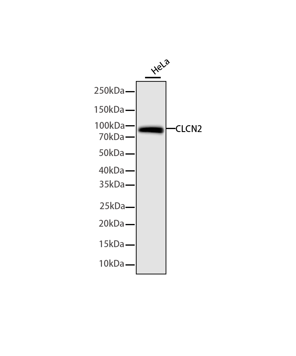CLCN2 Rabbit mAb