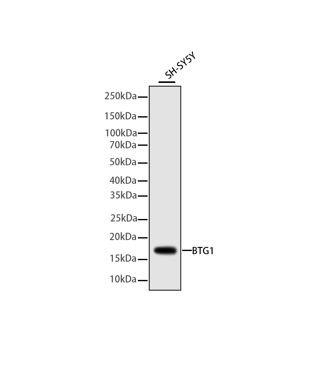 BTG1 Rabbit mAb