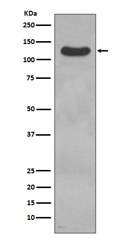 CD31  Rabbit mAb