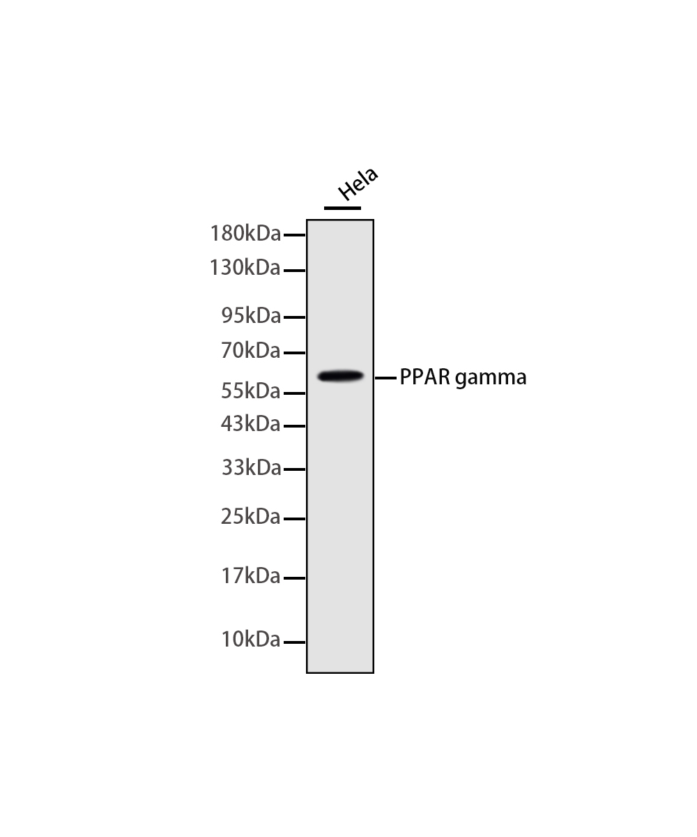 PPAR gamma Rabbit mAb