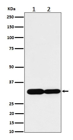 Caspase-6 Rabbit mAb