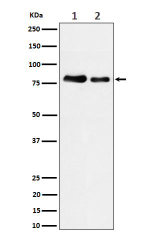 PKC Rabbit mAb