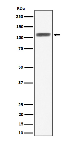 HIF-1-alpha Rabbit mAb
