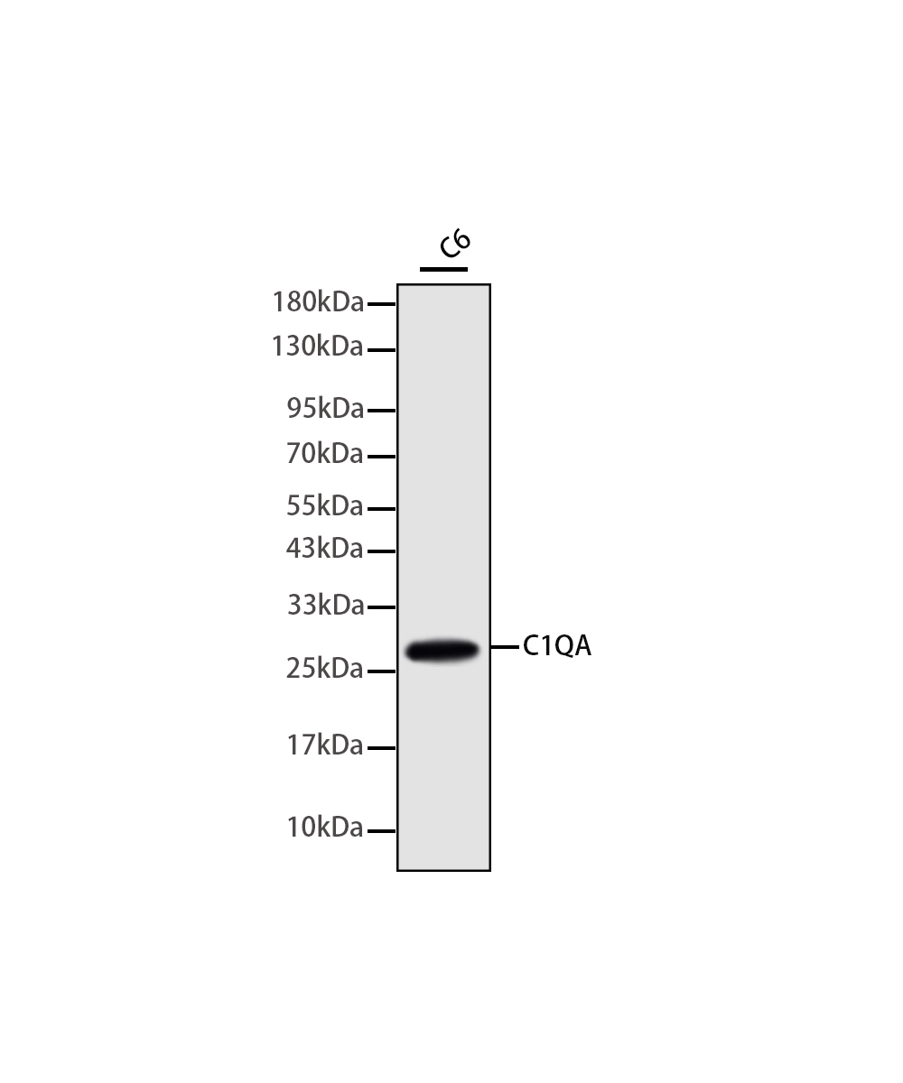 C1QA Rabbit mAb