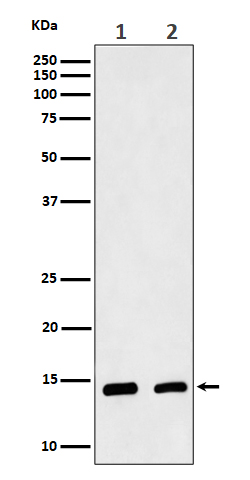 CRABP2 Rabbit mAb