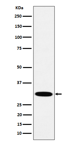 HMGCL Rabbit mAb
