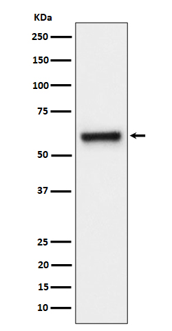 FPGS Rabbit mAb