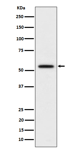 p60 katanin Rabbit mAb