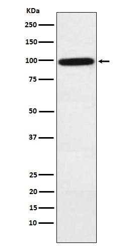 Complement factor B Rabbit mAb