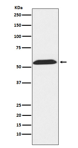 TXNRD2 Rabbit mAb