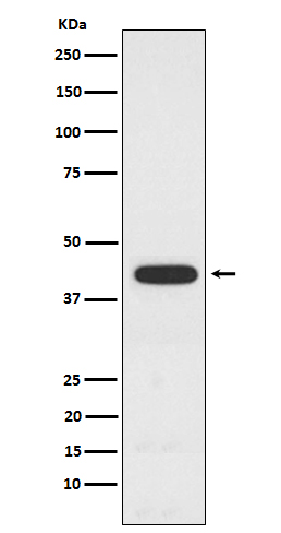 PCYT1A Rabbit mAb