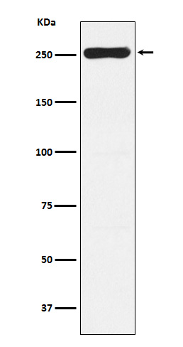 WNK1 Rabbit mAb