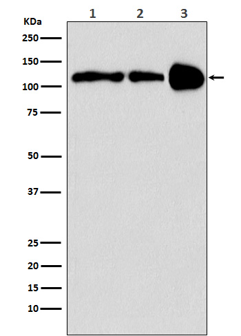 PGC1 beta Rabbit mAb