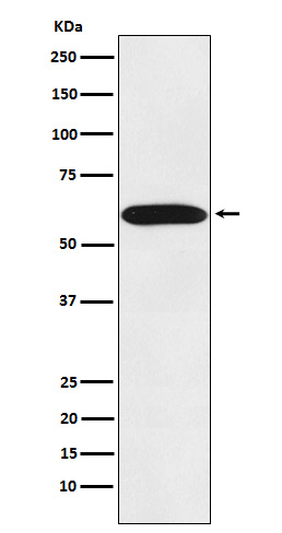 STIP1 Rabbit mAb