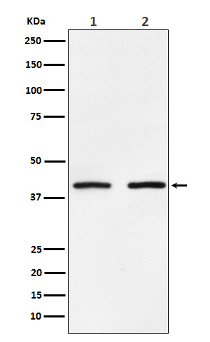 SMYD3 Rabbit mAb