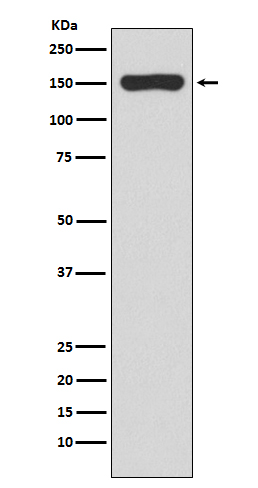 RNA polymerase beta Rabbit mAb