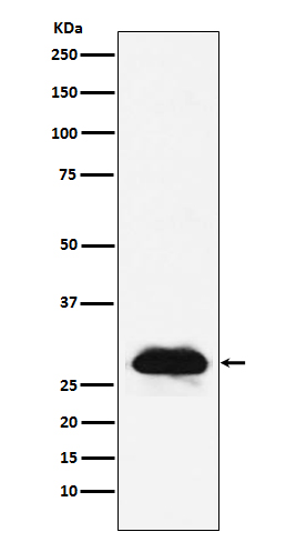 Carbonic anhydrase 2 Rabbit mAb