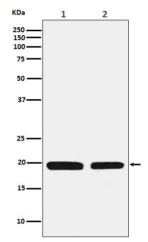 Ferritin Light Chain Rabbit mAb