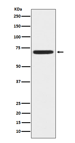 ZAP70 Rabbit mAb