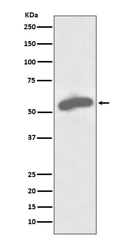 G6PD Rabbit mAb