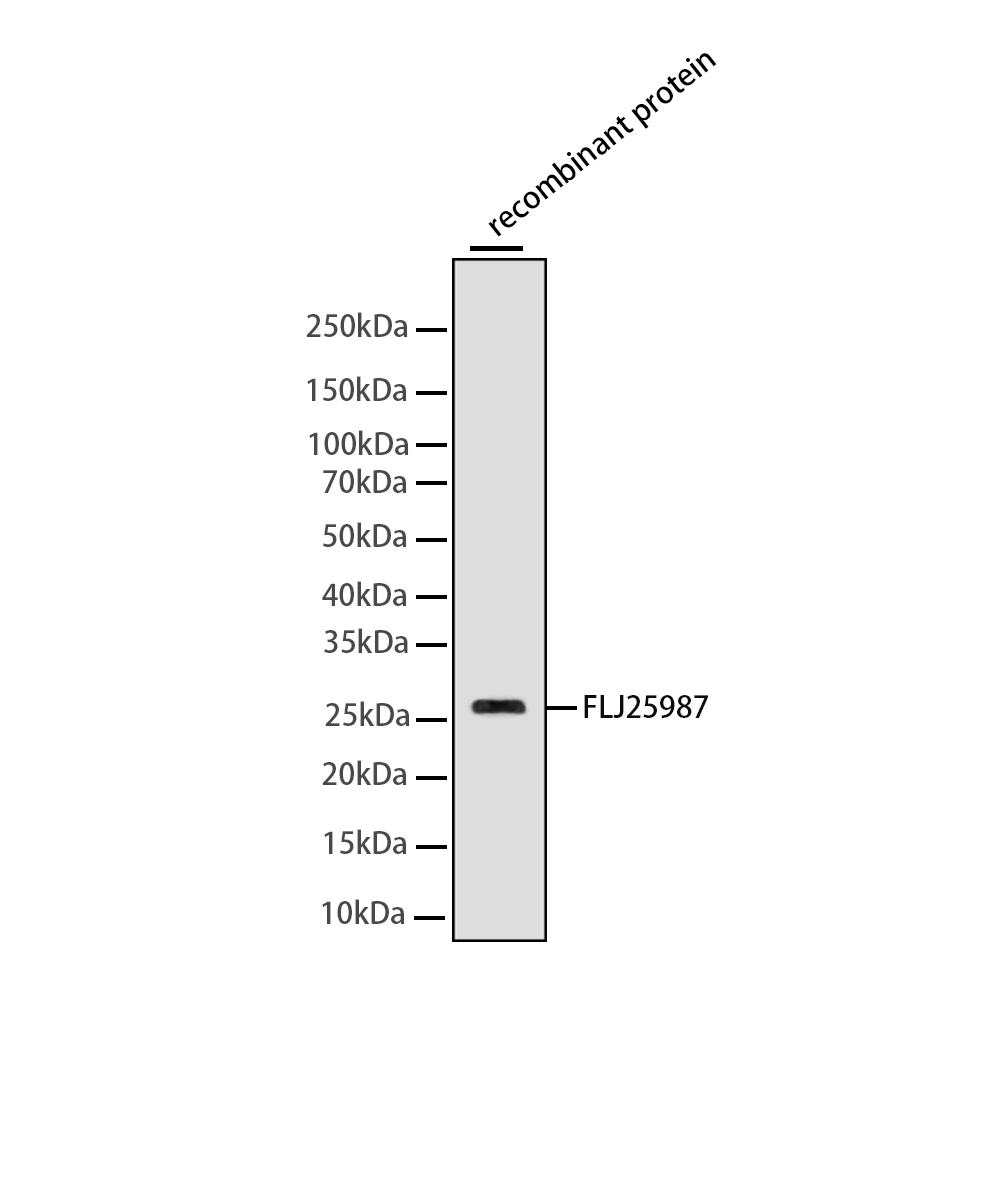 K63-linkage Specific Ubiquitin Rabbit mAb