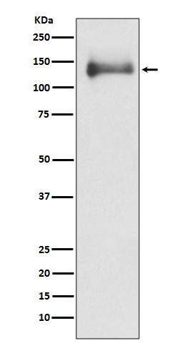 HDAC4 Rabbit mAb