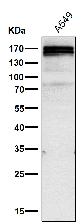 Gli1 Rabbit mAb