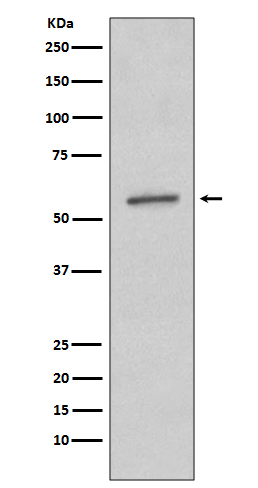 SGK1 Rabbit mAb