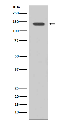 FGFR1 Rabbit mAb